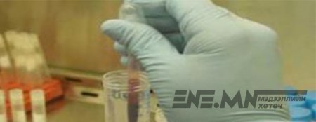 Хөвсгөл аймагт хүн боомоор өвчилжээ