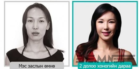 Мисс Э.Сэлэнгэ гоо сайхны хагалгаанд орсон мөнгөө ингэж олов