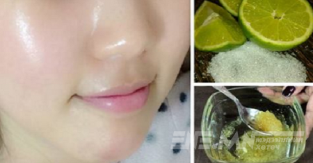 Нимбэг ашиглан үхэжсэн арьсаа сэргээж, толбоо арилгах арга