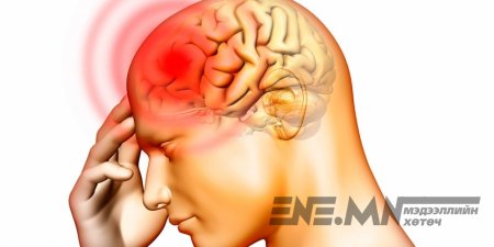 Менингит өвчнөөс урьдчилан сэргийлэх зөвлөмж