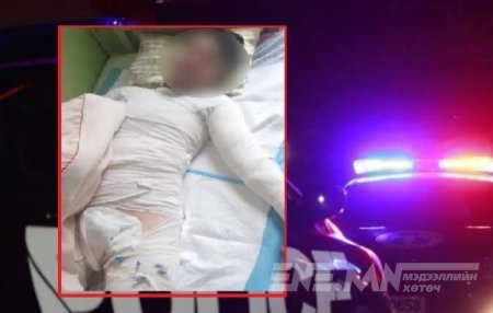 26 настай, эрэгтэйг бүлэглэн зодож, шатаасан этгээдүүдийг баривчилжээ